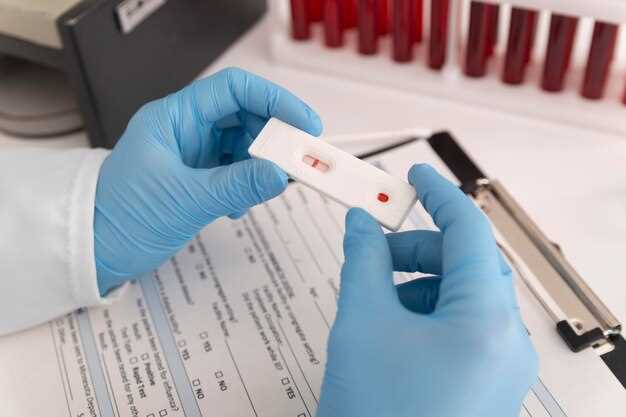 Лаборатории и поликлиники - основные места взятия крови на анализ на ВИЧ
