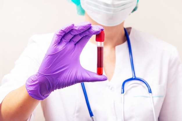 Кровь для анализа на ВИЧ - где ее берут?