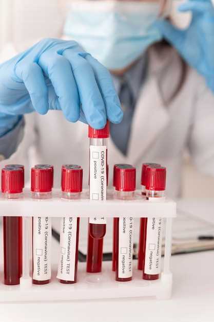 Основные показатели анализа крови при анемии