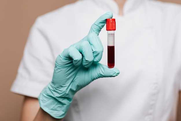 Показатели крови, изучаемые при общем анализе