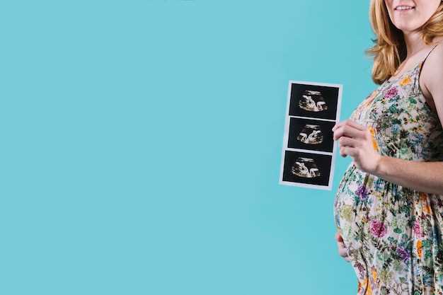Миома в матке и беременность: основные факты