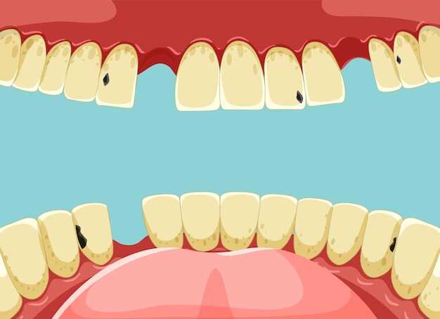 Значение анатомической структуры для перекрытия зубов