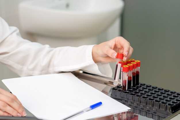 Общий анализ крови: сроки и подготовка
