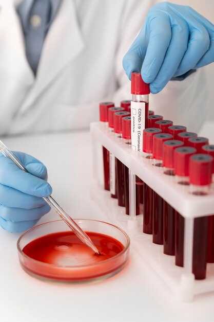 Что такое общий клинический анализ крови и как он проводится?