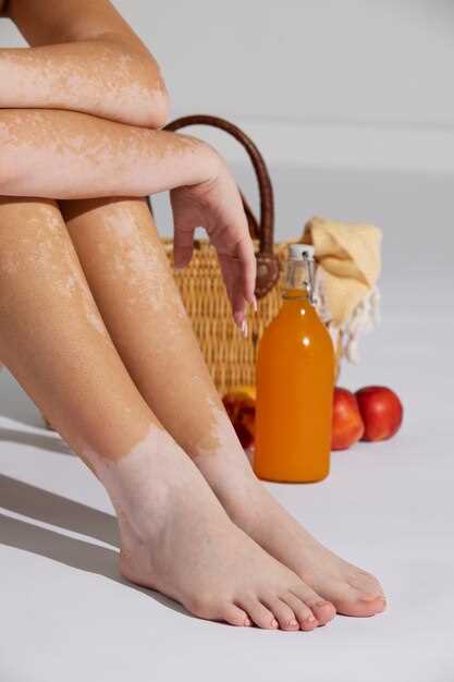 Дефицит витамина А: влияние на кожу ног